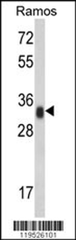 HLA-DRA Antibody (N-term)