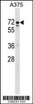 USP17L2 Antibody (C-term)