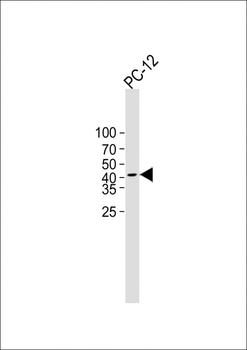 PDHE1A(S232) Antibody