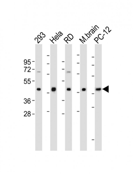 PDHE1A(S232) Antibody