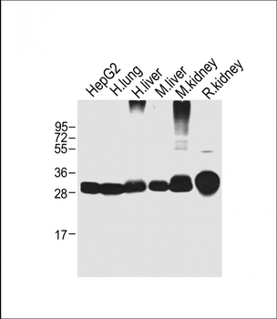 SULT1A1 Antibody