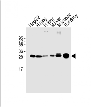 SULT1A1 Antibody