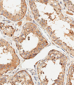 MUT Antibody (N-Term)