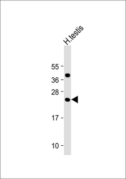 FAM3A Antibody (C-Term)