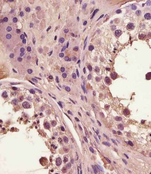 FAM3A Antibody (C-Term)