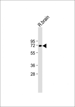 SLC17A6 Antibody (Center)