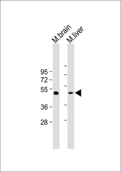 gamma Tubulin Antibody