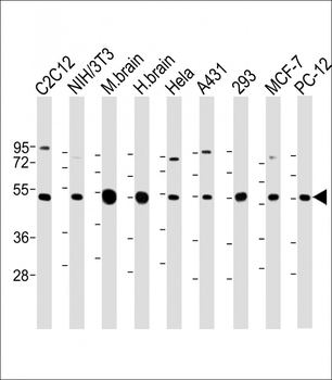 beta II Tubulin Antibody