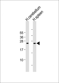 GCA Antibody (N-Term)