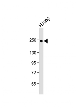 COL14A1 Antibody (Center)