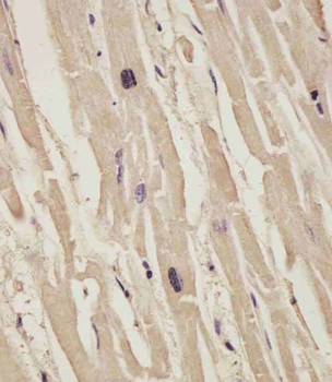 COL14A1 Antibody (Center)