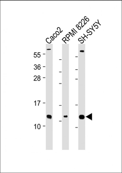 CKS2 Antibody (N-Term)