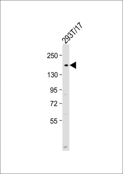POLA1 Antibody (N-Term)