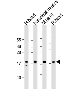 MYL2 Antibody (Center)