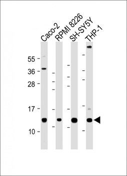 CKS2 Antibody (C-Term)