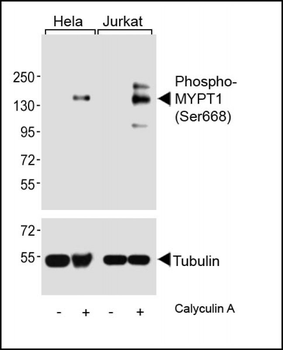 Phospho-MYPT1 (Ser668) Antibody