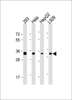 STUB1 Antibody (C-term)