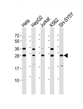 HSD17B10 Antibody (N-Term)
