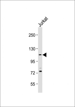 PKN1 Antibody (C-Term)