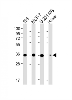 PDXK Antibody (N-term)