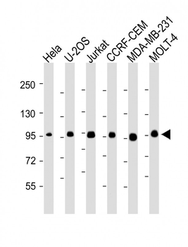 RANBP9 Antibody