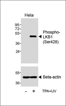 Phospho-LKB1 (Ser428) Antibody