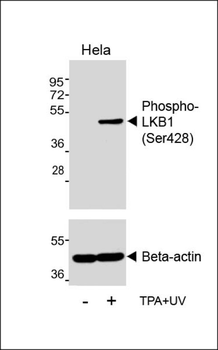 Phospho-LKB1 (Ser428) Antibody