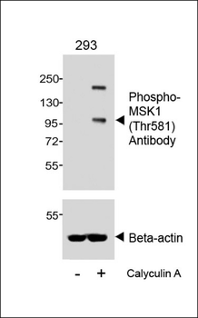 Phospho-MSK1 (Thr581) Antibody
