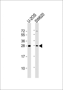TK1 Antibody (Center)