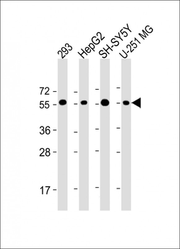 PEPD Antibody (C-Term)