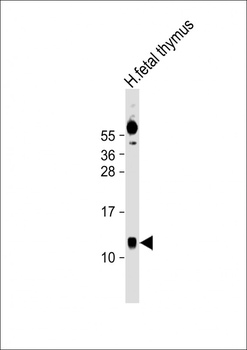 AHSP Antibody (Center)