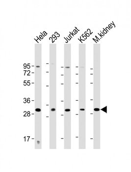 HOXB4 Antibody (Center)