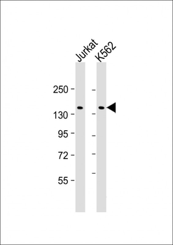 KANK1 Antibody