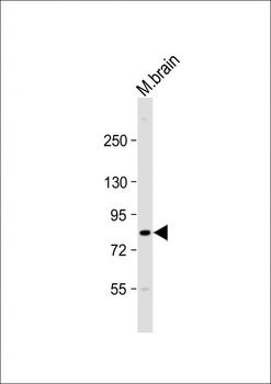 KIAA1524 Antibody (N-Term)