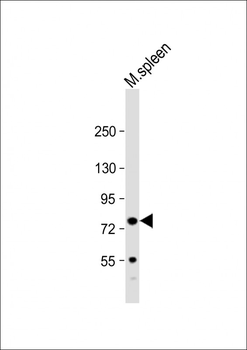 FERMT3 Antibody (N-Term)