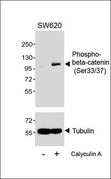 Phospho-beta-catenin (Ser33/37) Antibody