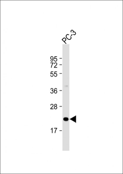 APOBEC3C Antibody (C-Term)