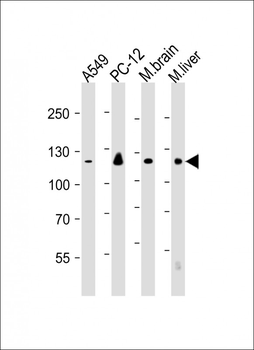 EIF2AK3 Antibody