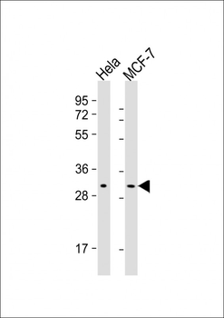 RAB20 Antibody