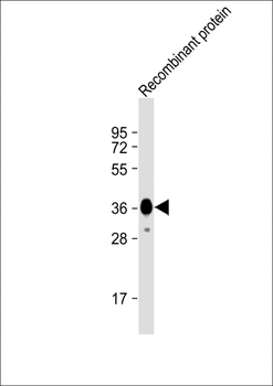 MYO18B Antibody