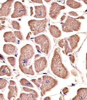 MYO18B Antibody