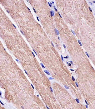 MYO18B Antibody