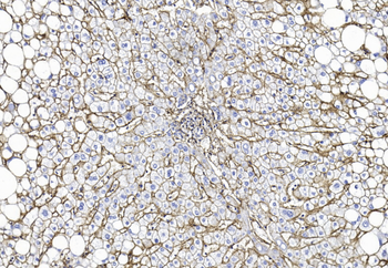 CD81 Antibody