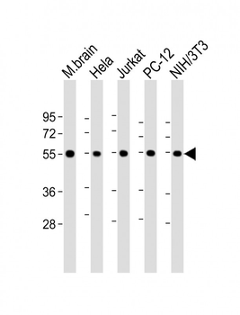 beta II Tubulin Antibody