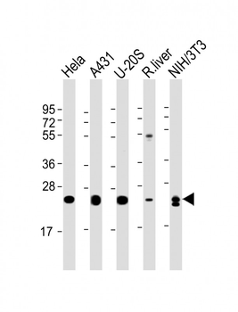 RAB1B Antibody