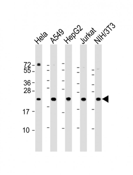 RPS7 Antibody (N-Term)