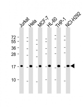 RPS17 Antibody (Center)