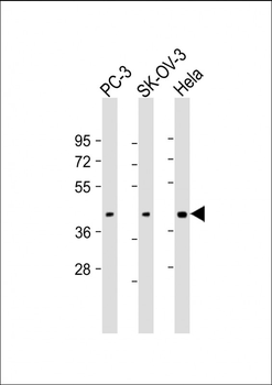 ST3GAL4 Antibody (N-Term)