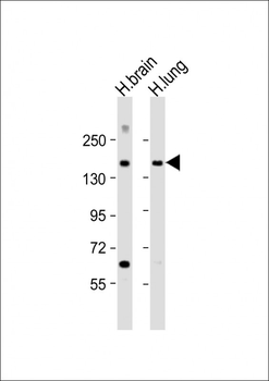 MTUS1 Antibody (N-Term)