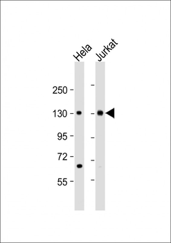 MTUS1 Antibody (C-Term)